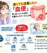 🩸【要注意】「痔だと思っていた」36歳女性、大腸がんステージ3と診断…😨のサムネイル